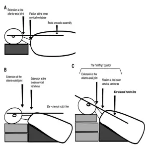 Intubation Position